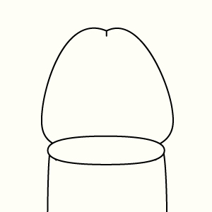 ヒアルロン酸
